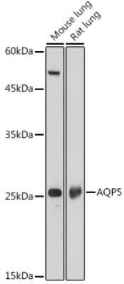 Western Blot: Aquaporin-5 AntibodyAzide and BSA Free [NBP3-02963]